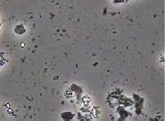 除菌後の顕微鏡画像