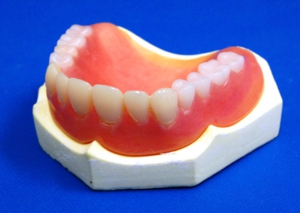 ウェルデンツ　義歯